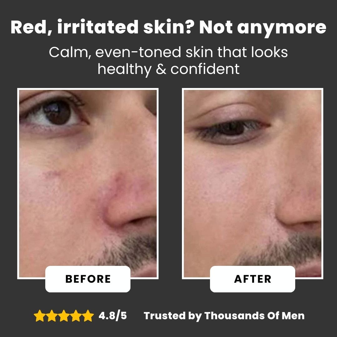 Golden Tallow | Tallow Honey Balm